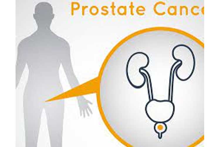 How to Prevent Prostate Cancer Through These 5 Things