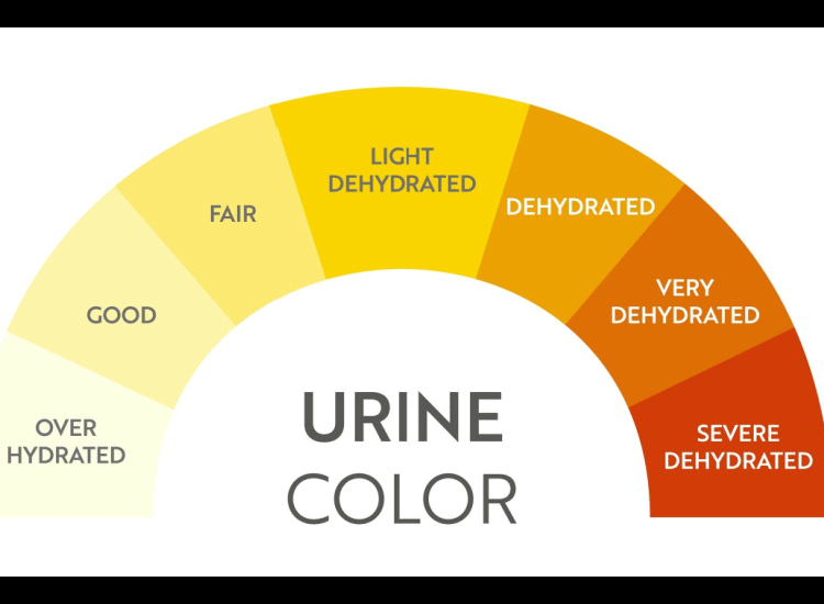 Recognize These Abnormal and Healthy Urine Colors